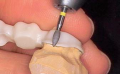KLNK/ SET Zirkon Abutment hazırlama ve kesme, Z-Cut Diamond Instruments Zirconia