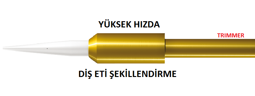 TRIMMER